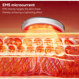 Under-Eye Red Light Therapy